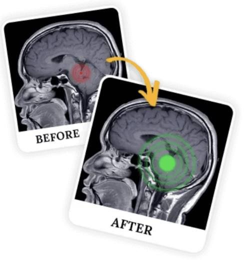 Benefits of The Brain Song – improved focus, memory, learning, and overall brain health.